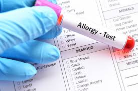 Allergy Range